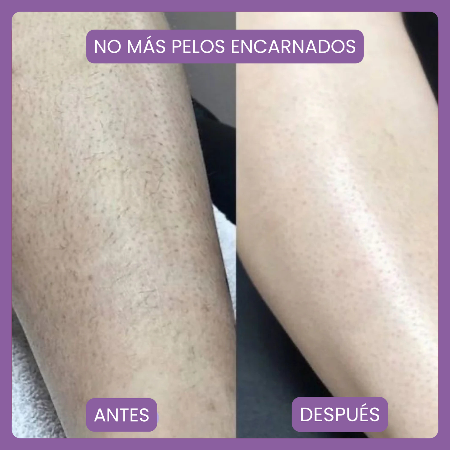 Depilador Borrador de Vello